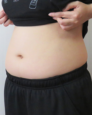 痩せる前の腹部の写真